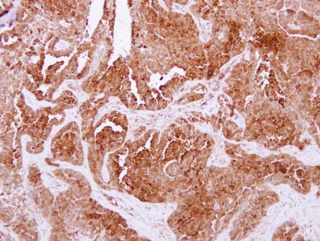 NPC2 Antibody in Immunohistochemistry (Paraffin) (IHC (P))