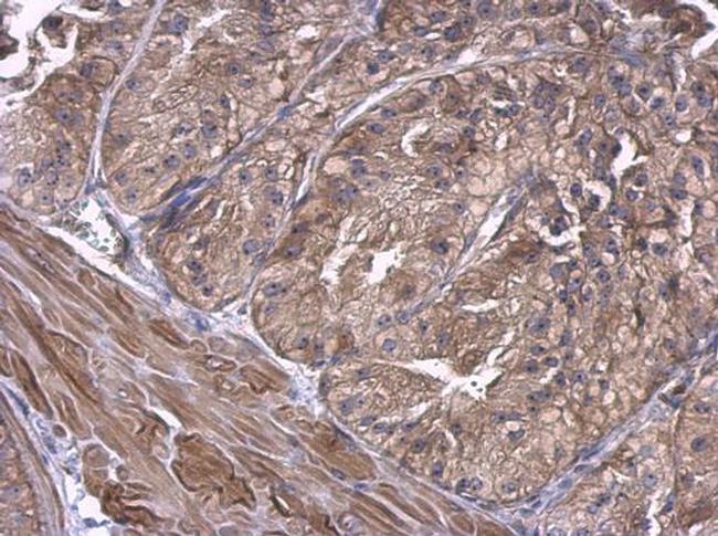 UBE2D1 Antibody in Immunohistochemistry (Paraffin) (IHC (P))