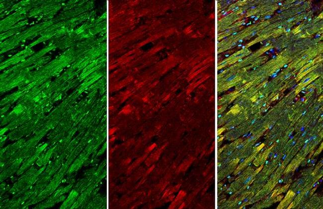 Cardiac Troponin I Antibody in Immunohistochemistry (Paraffin) (IHC (P))