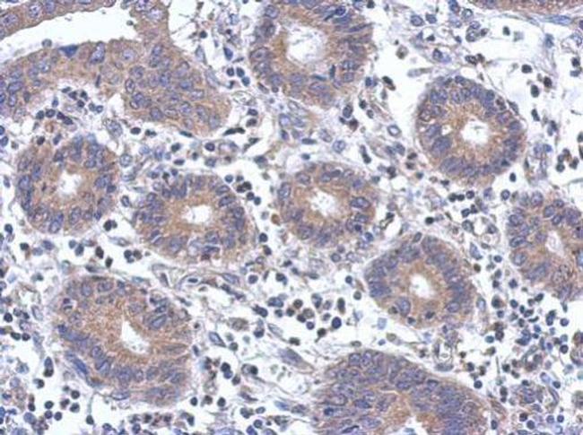 Fyn Antibody in Immunohistochemistry (Paraffin) (IHC (P))