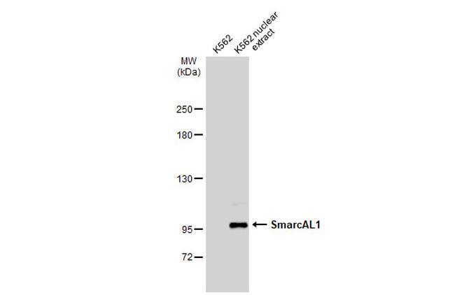 SMARCAL1 Antibody in Western Blot (WB)