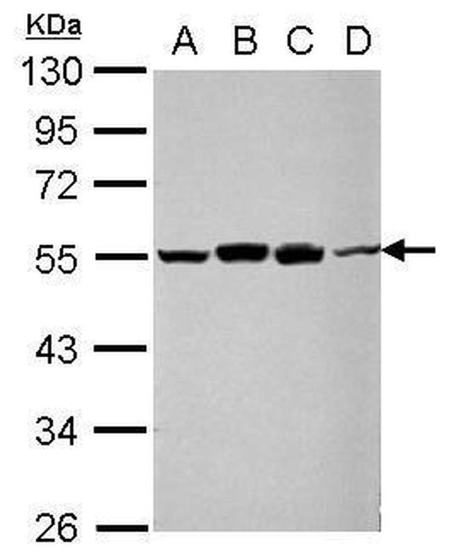 RUVBL1 Antibody in Western Blot (WB)