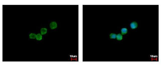 CSF3R Antibody in Immunocytochemistry (ICC/IF)