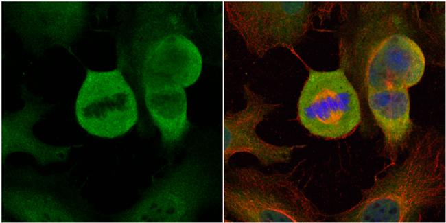 MAD1 Antibody in Immunocytochemistry (ICC/IF)