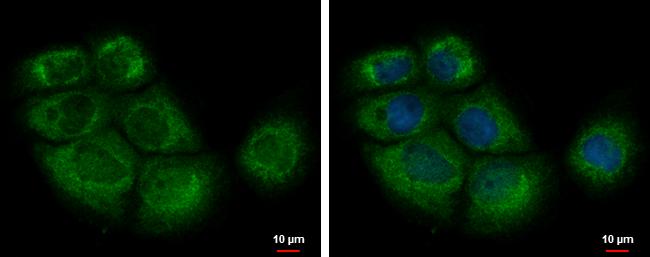 eIF2b alpha Antibody in Immunocytochemistry (ICC/IF)