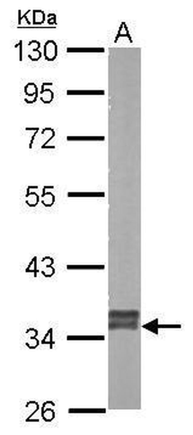 GRHPR Antibody in Western Blot (WB)