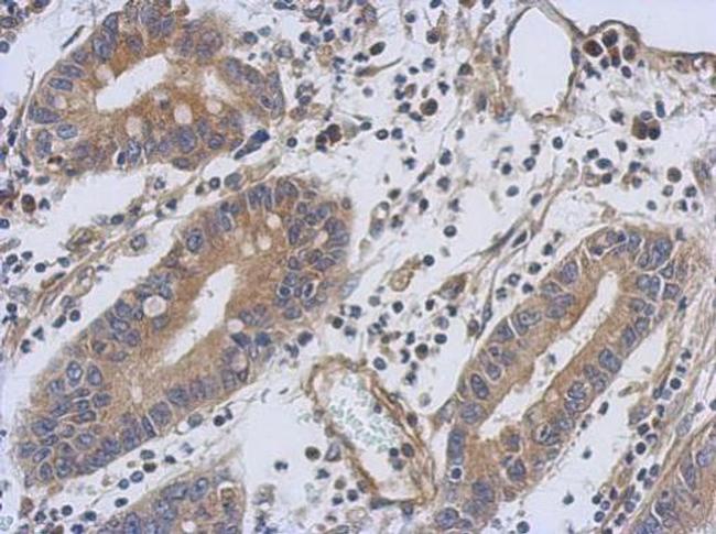 TNNT1 Antibody in Immunohistochemistry (Paraffin) (IHC (P))