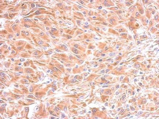 IMPA1 Antibody in Immunohistochemistry (Paraffin) (IHC (P))