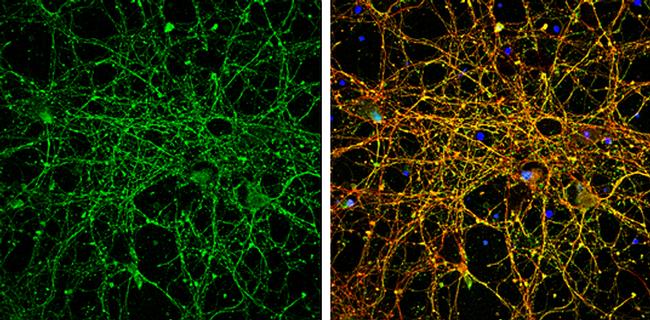 EEA1 Antibody in Immunocytochemistry (ICC/IF)