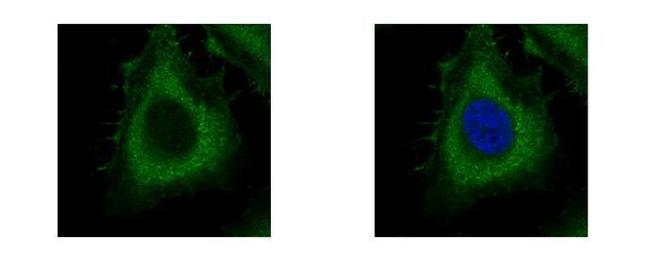 Dynamin 2 Antibody in Immunocytochemistry (ICC/IF)