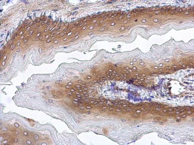 STUB1 Antibody in Immunohistochemistry (Paraffin) (IHC (P))