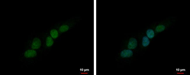 PHOX2B Antibody in Immunocytochemistry (ICC/IF)