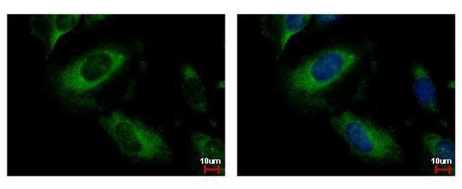 PPM1A Antibody in Immunocytochemistry (ICC/IF)