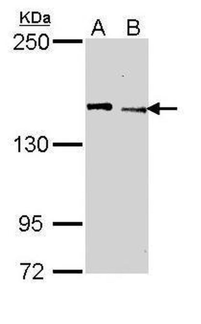 JARID1C Antibody in Western Blot (WB)