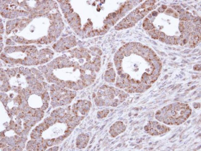 B3GALTL Antibody in Immunohistochemistry (Paraffin) (IHC (P))