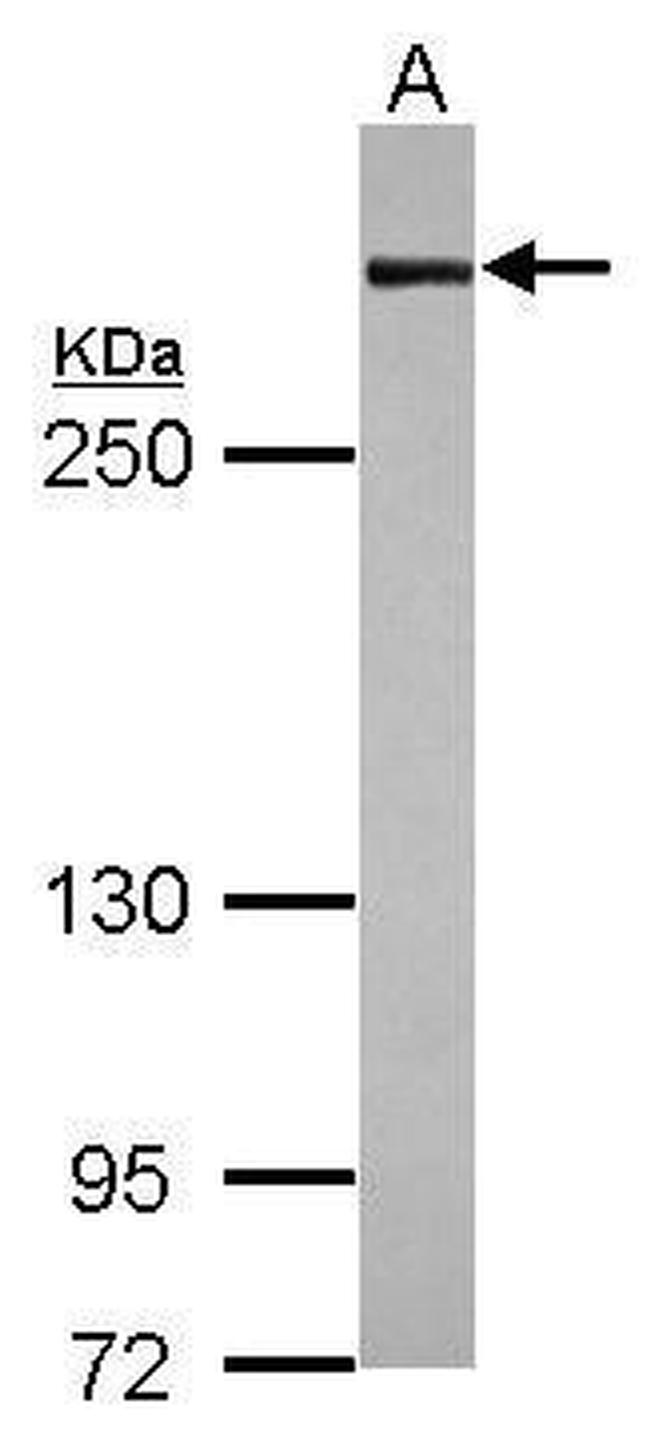 Filamin A alpha-1 Antibody in Western Blot (WB)