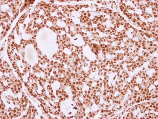 Ku80 Antibody in Immunohistochemistry (Paraffin) (IHC (P))