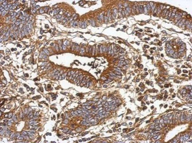 GC Antibody in Immunohistochemistry (Paraffin) (IHC (P))