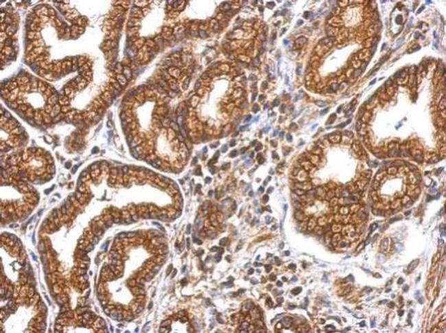 MYO1A Antibody in Immunohistochemistry (Paraffin) (IHC (P))