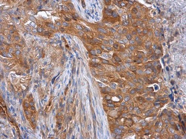 Tara Antibody in Immunohistochemistry (Paraffin) (IHC (P))