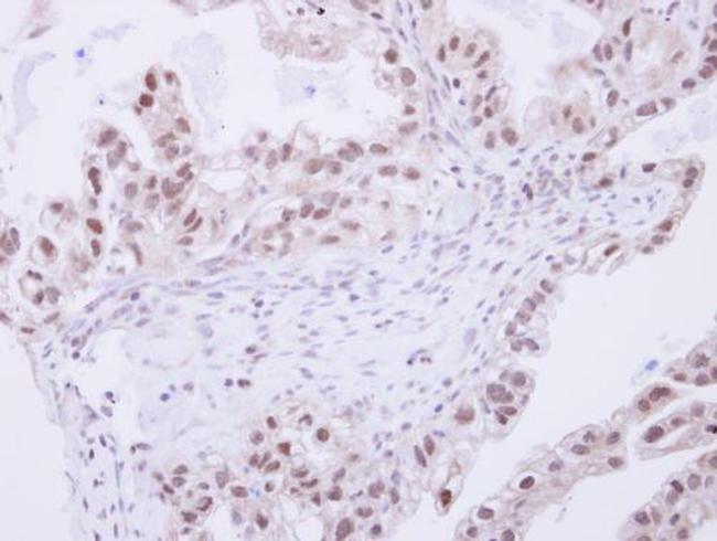 SNW1 Antibody in Immunohistochemistry (Paraffin) (IHC (P))