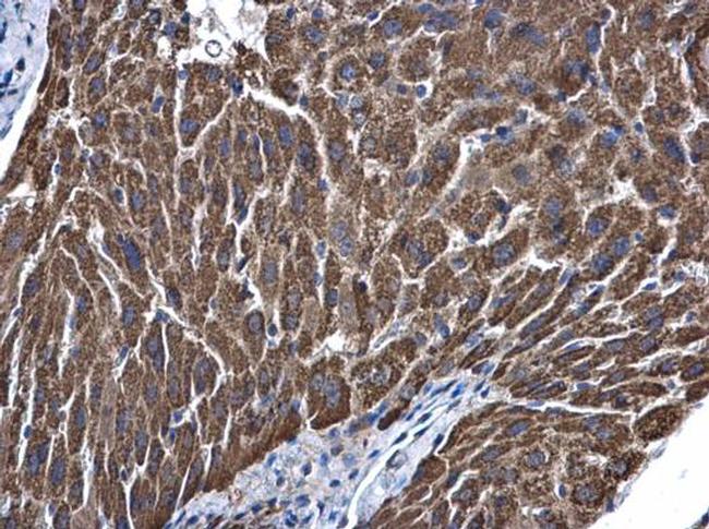 ALDH5A1 Antibody in Immunohistochemistry (Paraffin) (IHC (P))