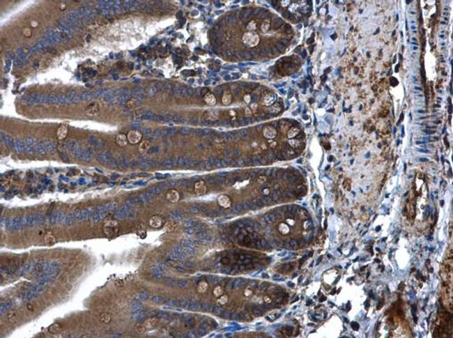 PLA2G4A Antibody in Immunohistochemistry (Paraffin) (IHC (P))