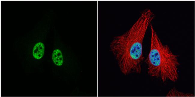 MCM3 Antibody in Immunocytochemistry (ICC/IF)