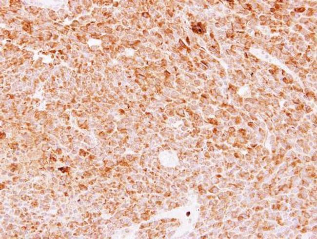 DMP4 Antibody in Immunohistochemistry (Paraffin) (IHC (P))