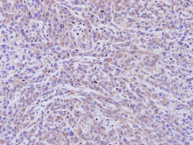 PDE11A Antibody in Immunohistochemistry (Paraffin) (IHC (P))