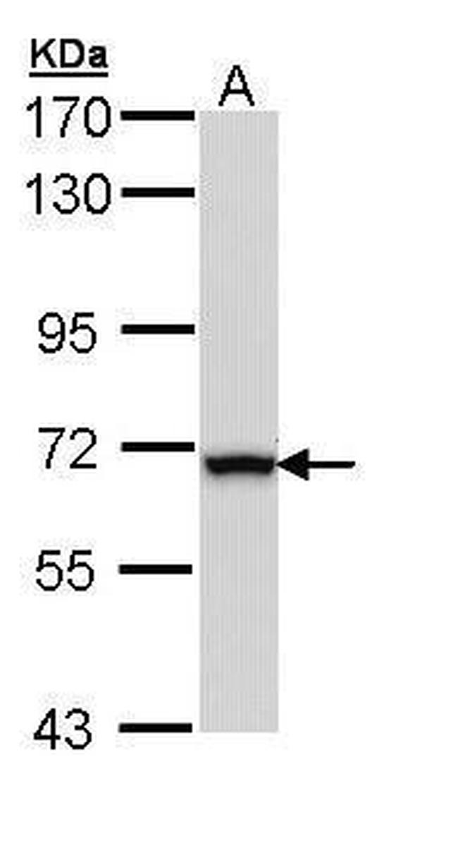 ALDH4A1 Antibody in Western Blot (WB)