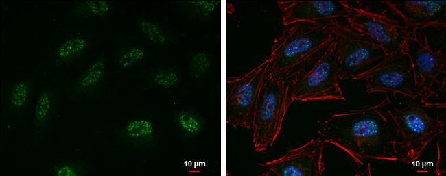 EZH2 Antibody in Immunocytochemistry (ICC/IF)