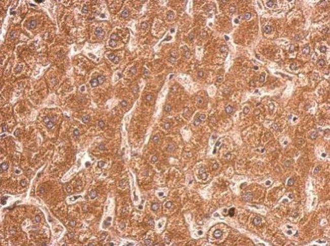 TFR2 Antibody in Immunohistochemistry (Paraffin) (IHC (P))