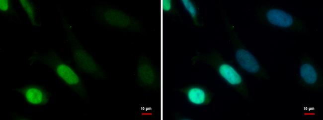 TDG Antibody in Immunocytochemistry (ICC/IF)