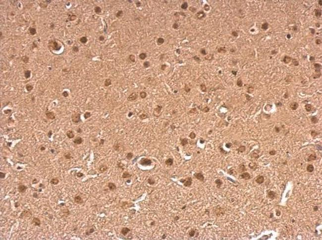 gamma Synuclein Antibody in Immunohistochemistry (Paraffin) (IHC (P))