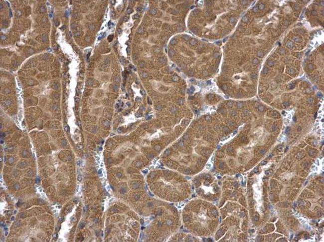 FRAT1 Antibody in Immunohistochemistry (Paraffin) (IHC (P))