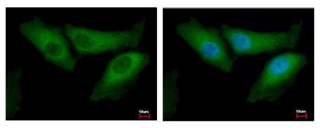 BID Antibody in Immunocytochemistry (ICC/IF)