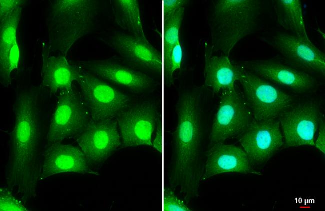 DDX3 Antibody in Immunocytochemistry (ICC/IF)