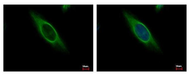 CAB39 Antibody in Immunocytochemistry (ICC/IF)