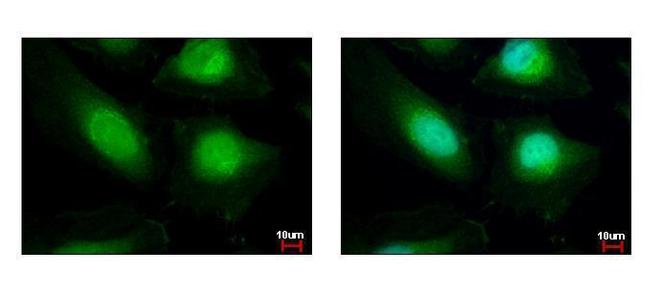 HAT1 Antibody in Immunocytochemistry (ICC/IF)