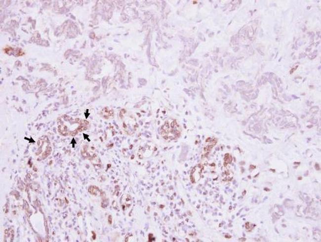 VCAM-1 Antibody in Immunohistochemistry (Paraffin) (IHC (P))