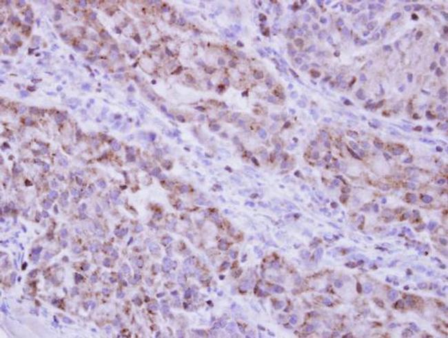 Catalase Antibody in Immunohistochemistry (Paraffin) (IHC (P))