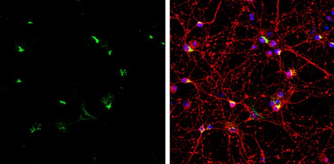 Sortilin Antibody in Immunocytochemistry (ICC/IF)