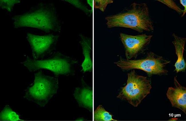 eIF5A Antibody in Immunocytochemistry (ICC/IF)