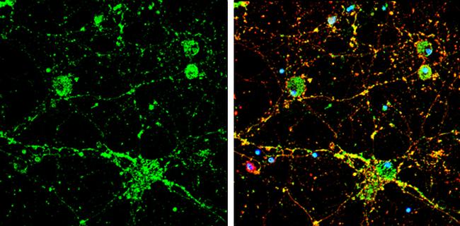 Calcineurin A Antibody in Immunocytochemistry (ICC/IF)