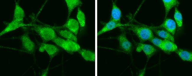 HSP701L Antibody in Immunocytochemistry (ICC/IF)