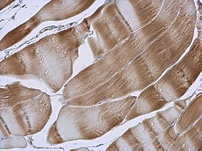 TID1 Antibody in Immunohistochemistry (Paraffin) (IHC (P))