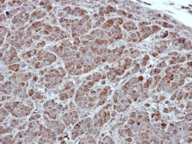 PKC alpha Antibody in Immunohistochemistry (Paraffin) (IHC (P))