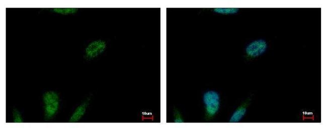 MCM3 Antibody in Immunocytochemistry (ICC/IF)