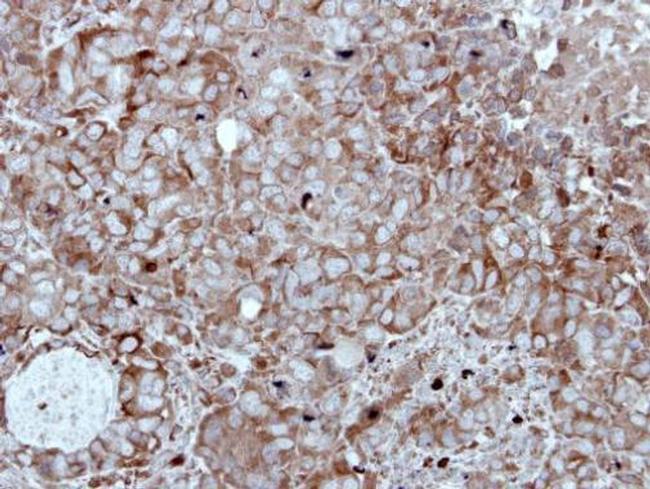 HIPPI Antibody in Immunohistochemistry (Paraffin) (IHC (P))